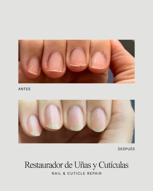Restaurador de Uñas – Nail Repair