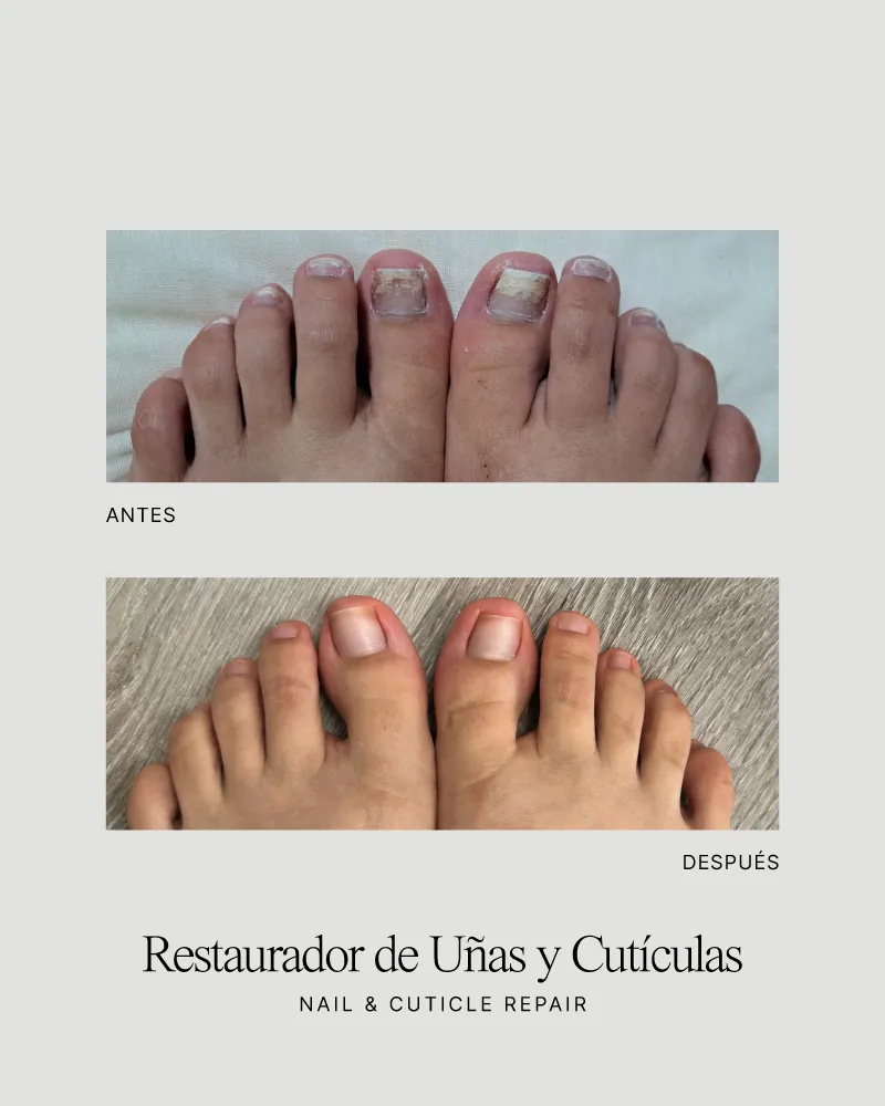 nail repair - restaurador de uñas 4