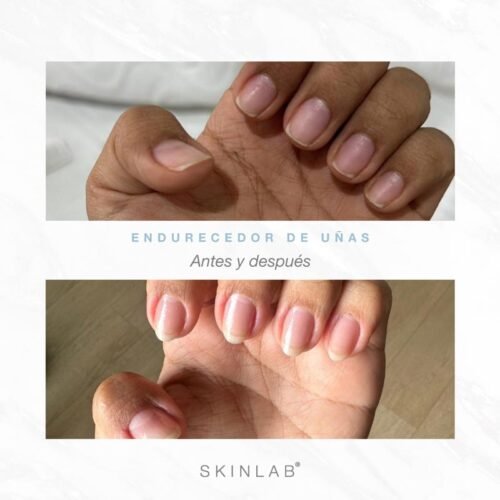 Endurecedor de Uñas – Nail Strengthener