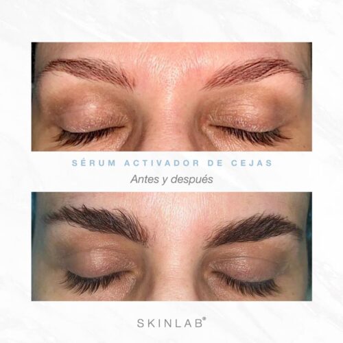 Sérum Activador de Cejas – Eyebrow growth booster