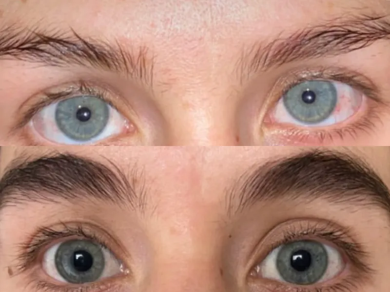 Lee más sobre el artículo Testimonio cejas 2
