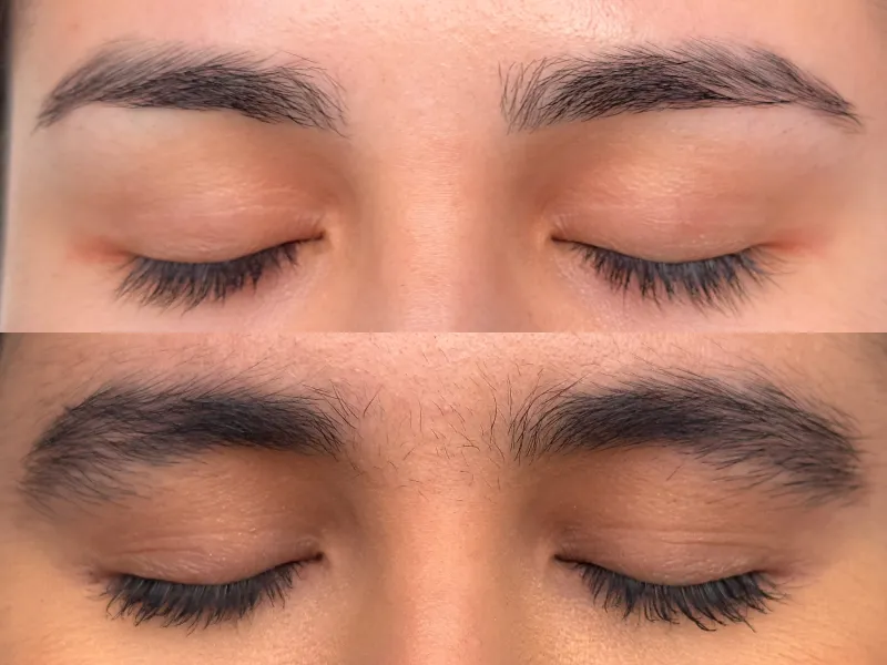 Lee más sobre el artículo Testimonio cejas 3