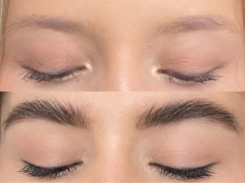 Lee más sobre el artículo Testimonio cejas 5