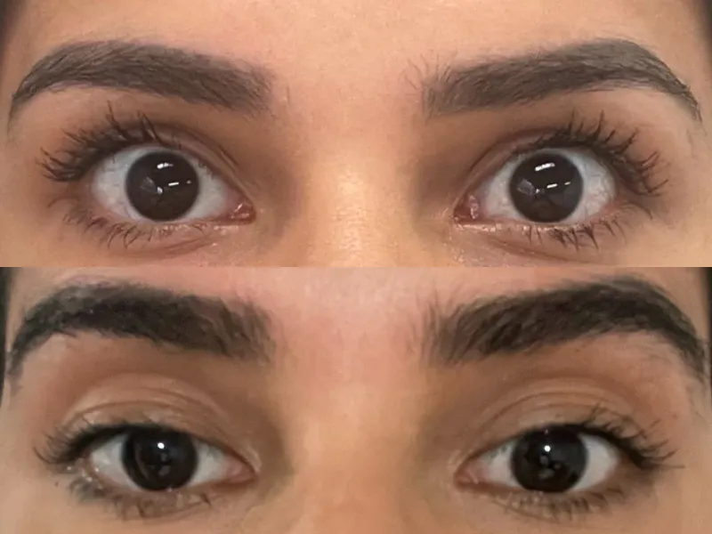 Lee más sobre el artículo Testimonio cejas 6