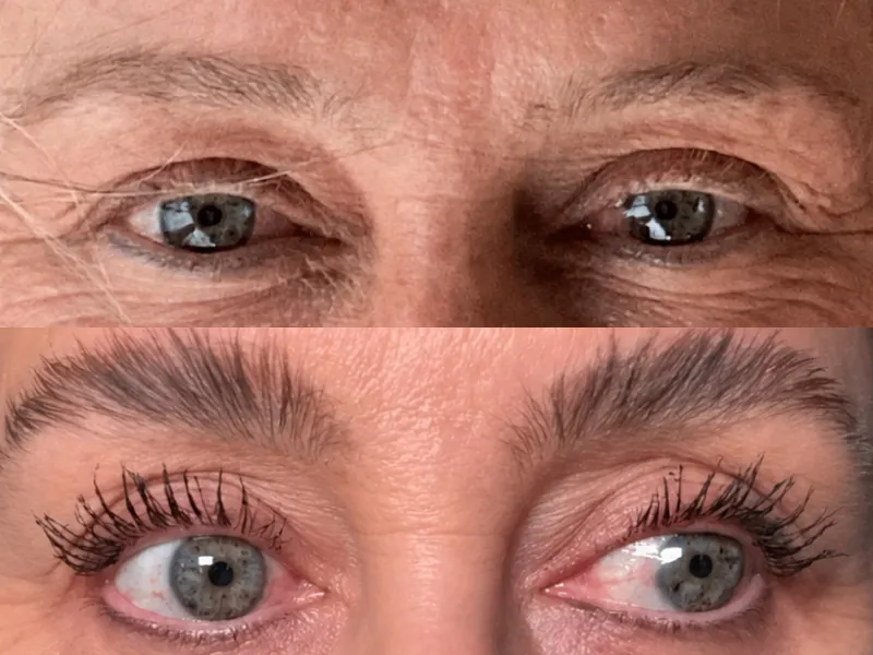 Lee más sobre el artículo Testimonio cejas 7