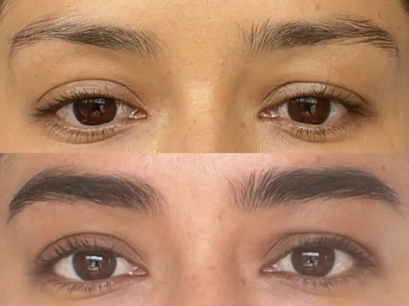 Lee más sobre el artículo Testimonio cejas 9