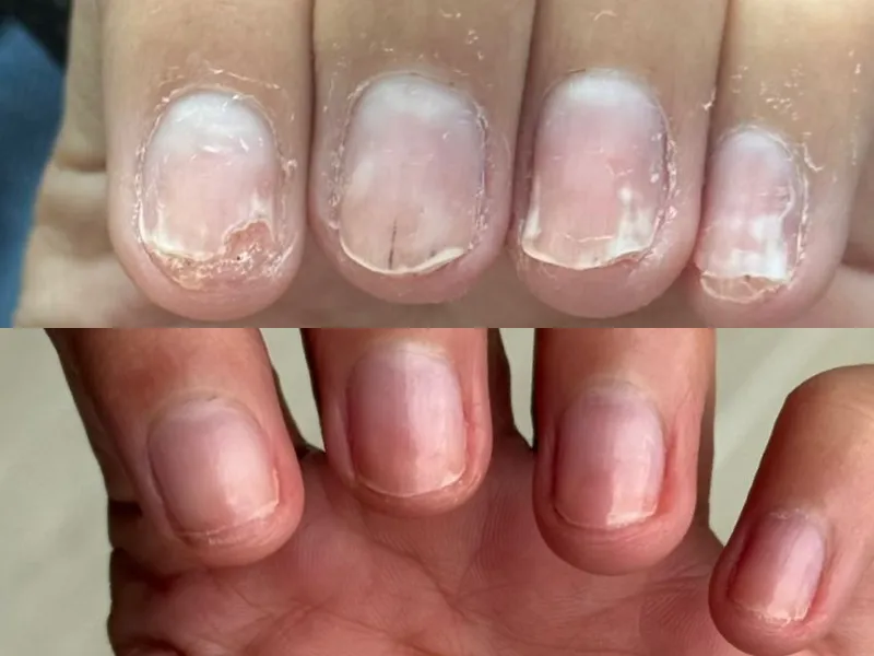 Lee más sobre el artículo Testimonio uñas 1