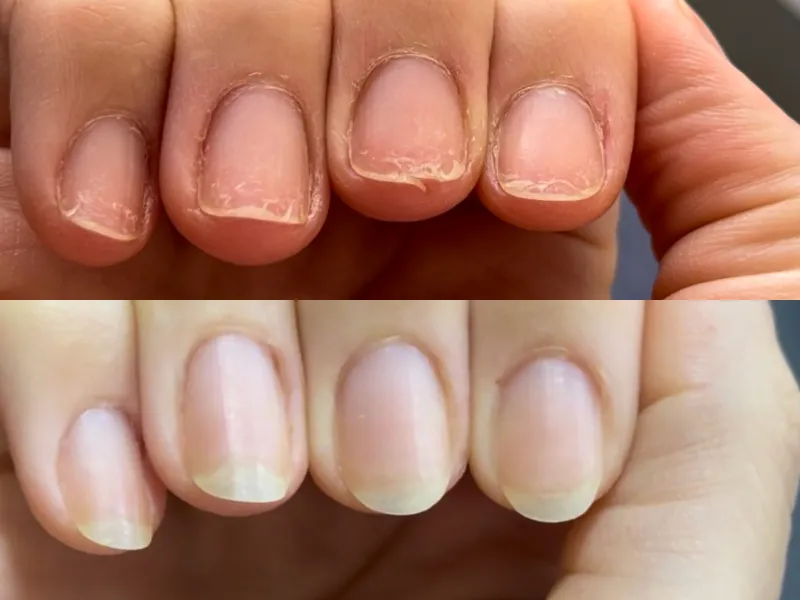 Lee más sobre el artículo Testimonio uñas 2