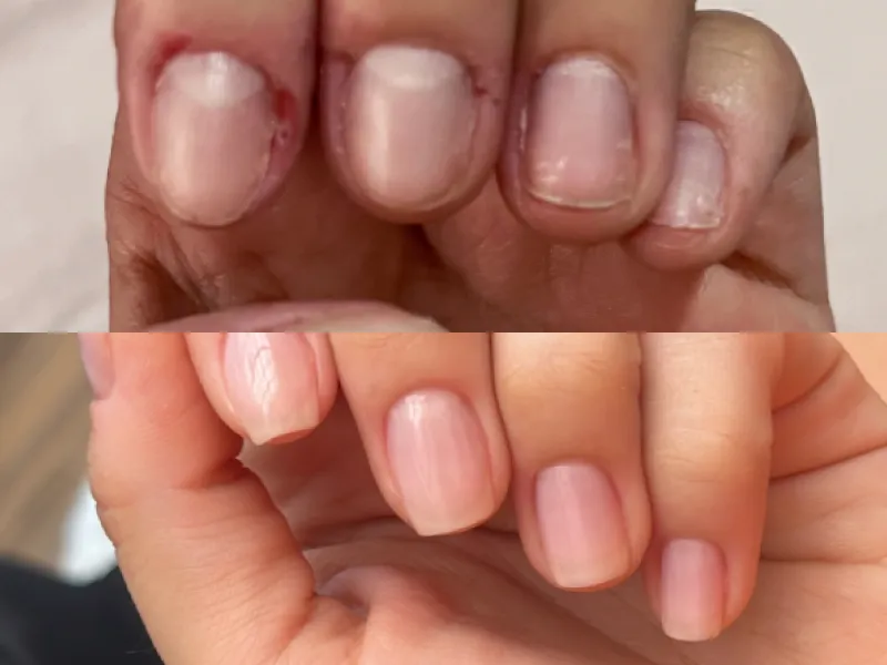 Lee más sobre el artículo Testimonio uñas 3