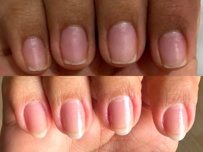 Lee más sobre el artículo Testimonio uñas 4