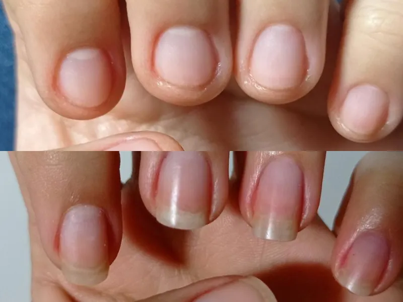 Lee más sobre el artículo Testimonio uñas 6