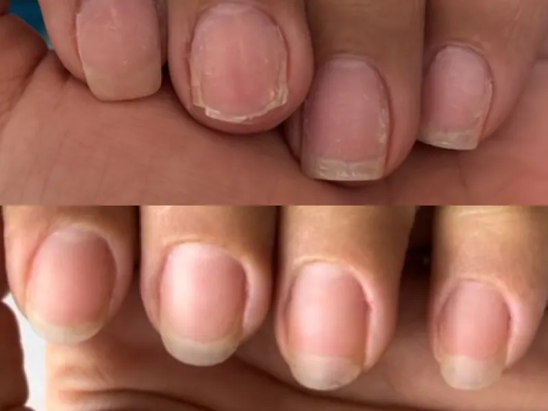 Lee más sobre el artículo Testimonio uñas 7
