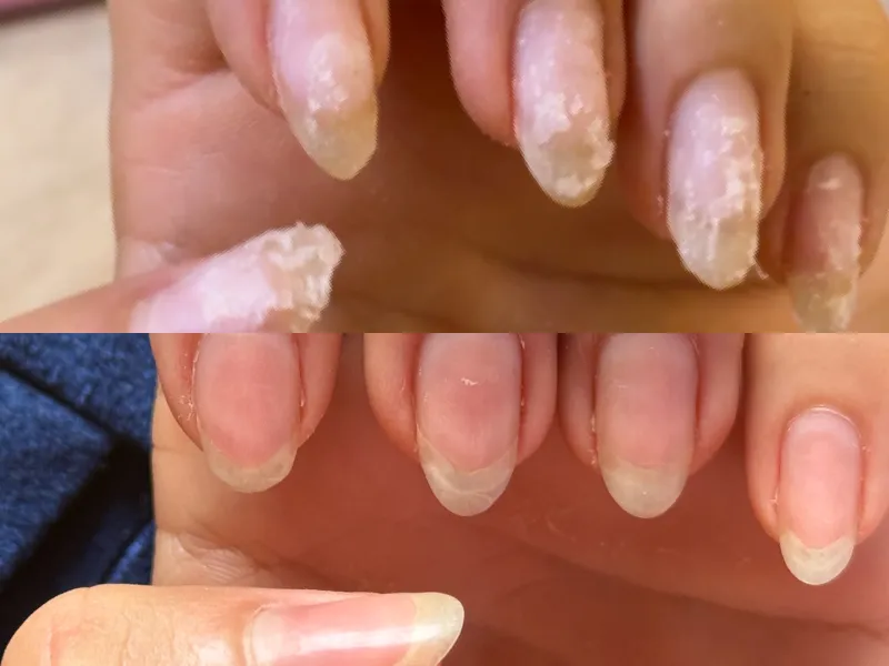 Lee más sobre el artículo Testimonio uñas 8