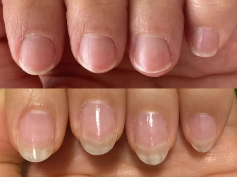 Lee más sobre el artículo Testimonio uñas 9